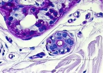 Page d’accueil - Page d’accueil Page d’accueil - Page d’accueil - Page d’accueil -photo maladie q58xzxj42gohv4toz3xqy2k3z75950mye6iyxi25ac - Page d’accueil